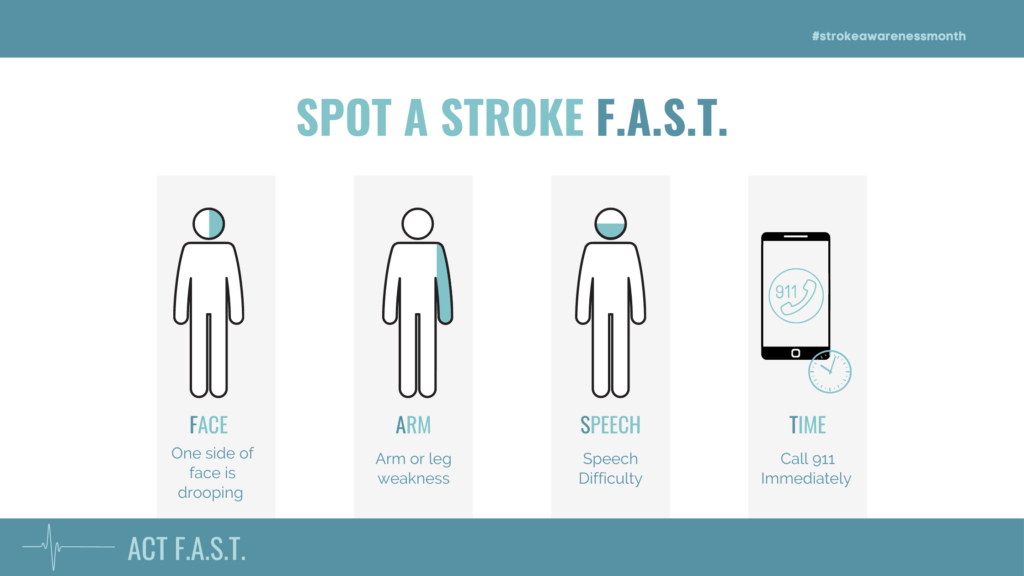 Spot A Stroke F.A.S.T.